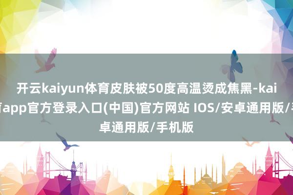 开云kaiyun体育皮肤被50度高温烫成焦黑-kai云体育app官方登录入口(中国)官方网站 IOS/安卓通用版/手机版