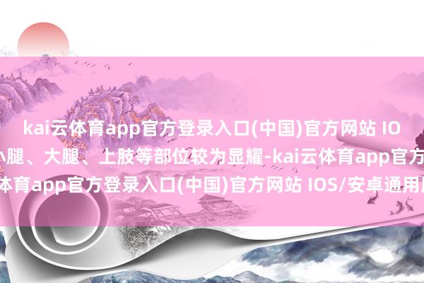 kai云体育app官方登录入口(中国)官方网站 IOS/安卓通用版/手机版以小腿、大腿、上肢等部位较为显耀-kai云体育app官方登录入口(中国)官方网站 IOS/安卓通用版/手机版